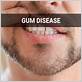 gum disease dyer