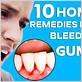 home treatment for bleeding gums