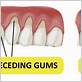 how to tell if gums are healthy