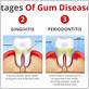 can gum disease cause mucus