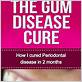 amazon gum disease