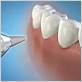 periodontal pockets waterpik