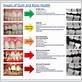 gum disease medical term