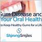 gum disease prevent infographic