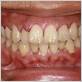 gum disease sydney