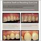 gum disease treatments in la crescenta