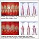 gum disease treatments kensington