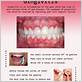 gingivitis oral hygiene
