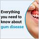 about gum disease