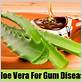 aloe vera plant for gum disease