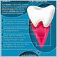 american dental hygienists association gum disease facts