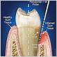 anatomy of gum disease