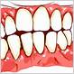 animated image gum disease