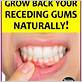 anti gum disease diet