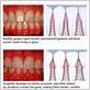 apopka gum disease treatments