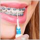 are flossing braces more effective
