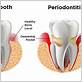 arnold gum disease treatments