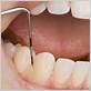 at home periodontal treatment