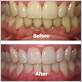 austin dentist gum disease