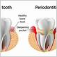 austin gum disease