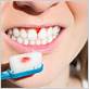 autoimmune disease causing bleeding gums when flossing