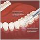 average cost of gum disease treatment