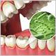 bacteria alzheimer's gum disease