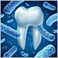 bacteria associated with gum disease