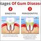 bad breath gum disease treatment