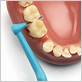 best brush to use for gum disease