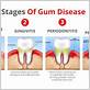 best gum disease doctor near me