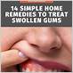 best thing for inflamed gums