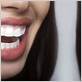 best to whiten teeth