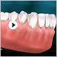 best treatment for gum disease bozeman mt