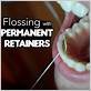 best way to floss with permanent retainer