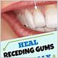 best way to heal gums