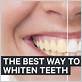 best way to whiten teeth