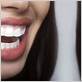 best way whiten teeth