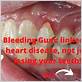 bleeding gum heart disease