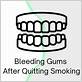 bleeding gums after quitting smoking