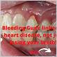 bleeding gums heart disease