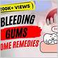 bleeding gums treatment home remedy