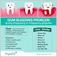 bleeding of gums during pregnancy