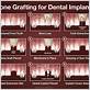 bone grafting gum disease