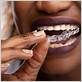 bruxism guard gum disease