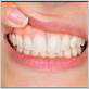 calcium therapy for gum disease