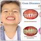 can a child have gum disease