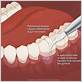 can a dentist fix gum disease