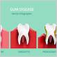can a dentist tell if you have gum disease