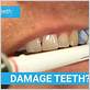 can an electric toothbrush damage gums